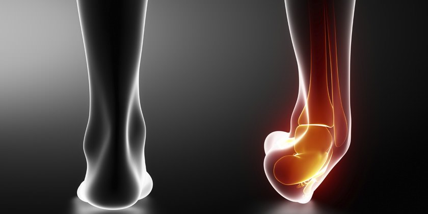 Atención médica para esguinces